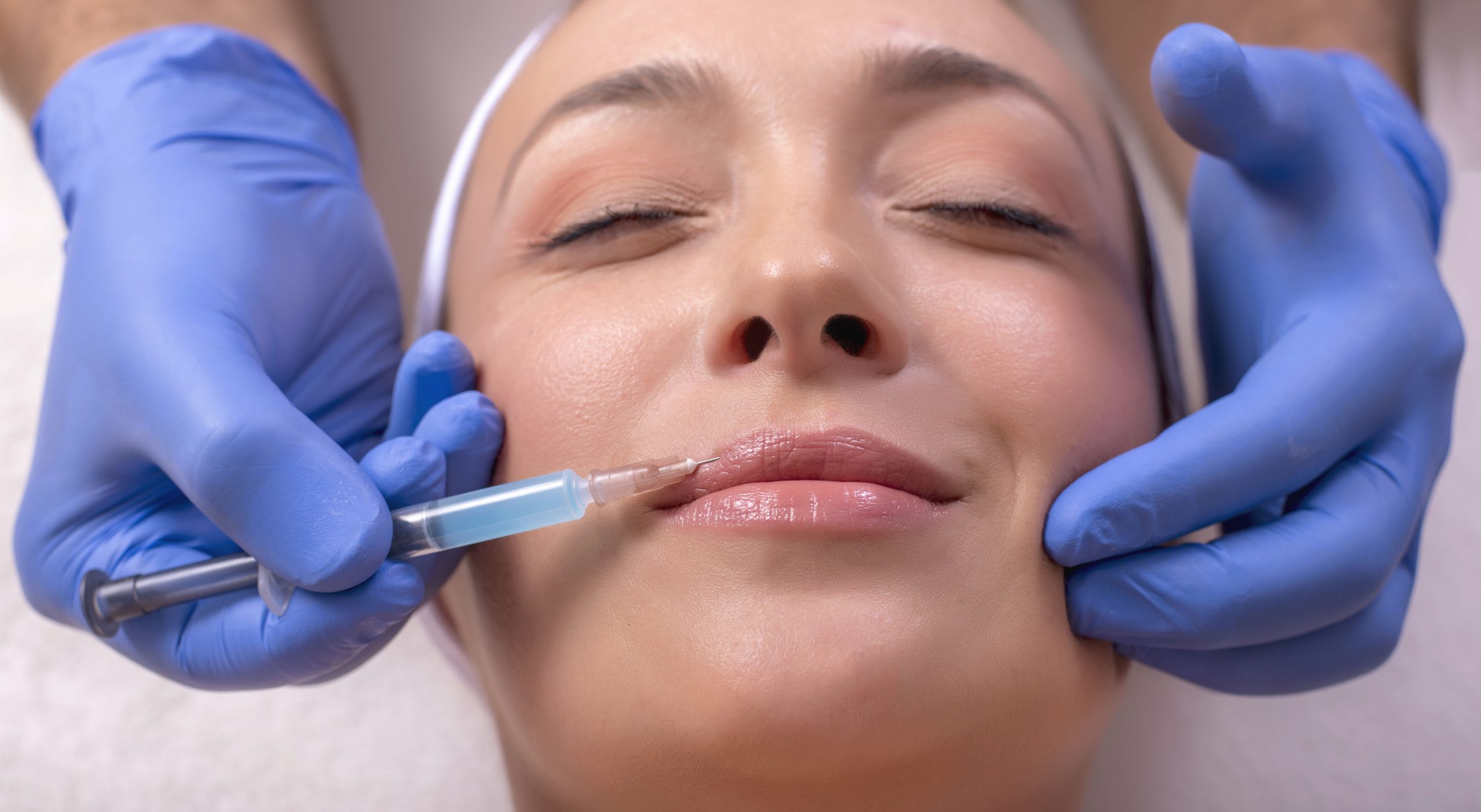 Dermal Fillers